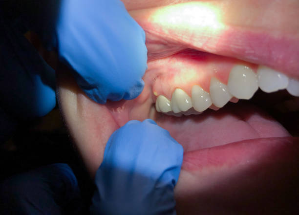 Best Urgent Tooth Repair  in Solvang, CA